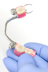 clasp denture on the lower jaw with supporting crowns in the hands of the dentist
