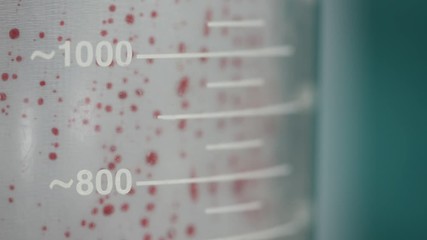 Close-up view of vacuum container and blood dripping during surgery