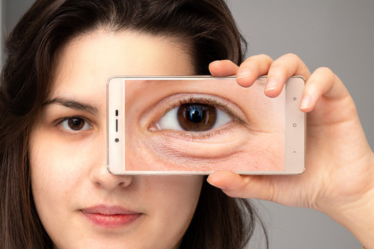 Girl showing the magnified photo of eye bag through her smart phone