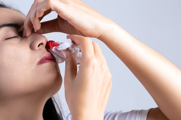 Nosebleed , a young woman with a bloody nose. Healthcare and medical concept.