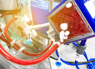 Extracorporeal membrane oxygenation (ECMO) in Seriously ill patients in intensive care unit with a artificial blood circulation apparatus,Blurry image.