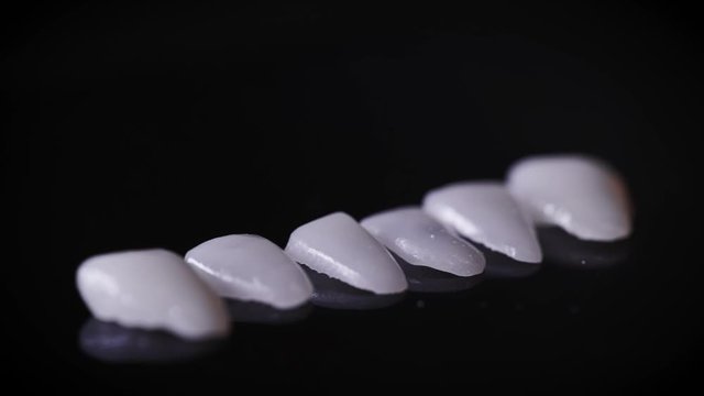 A macro shot of dental veneers. Veneers are special tooth pads that carry an aesthetic function. Modern precision manufacturing allows you to create the perfect smile.