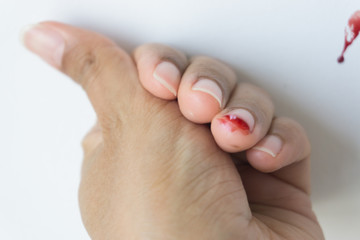 Red blood from finger, Accidents always happen.