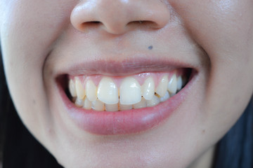 woman with white teeth
