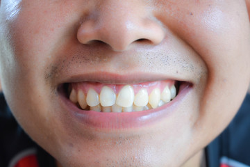 woman with white teeth