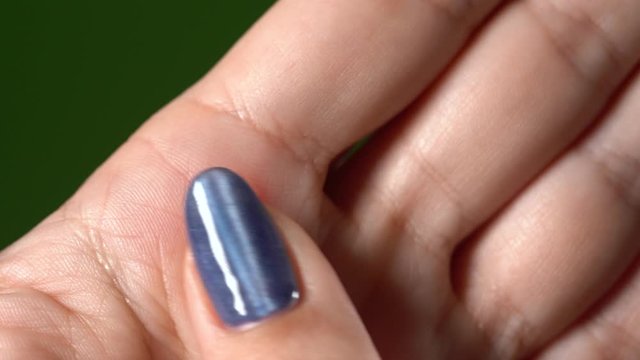 Closeup macro view of one small red callus on skin of palm of hand of white woman. Real time 4k video footage.