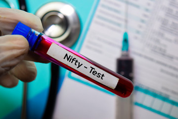 Nifty - Test with blood sample. Top view isolated on office desk. Healthcare/Medical concept