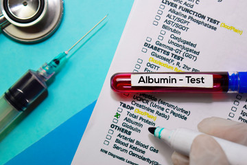 Albumin - Test with blood sample. Top view isolated on office desk. Healthcare/Medical concept