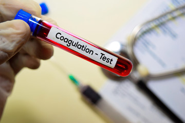 Coagulation - Test with blood sample. Top view isolated on office desk. Healthcare/Medical concept