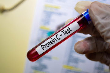 Protein C - Test with blood sample. Top view isolated on office desk. Healthcare/Medical concept