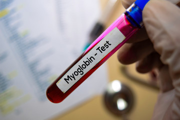 Myoglobin - Test with blood sample. Top view isolated on office desk. Healthcare/Medical concept