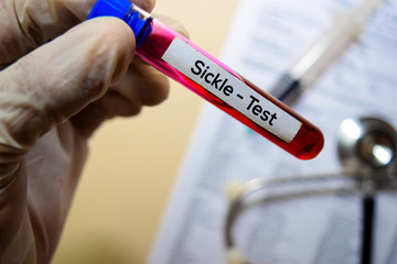 Sickle - Test with blood sample. Top view isolated on office desk. Healthcare/Medical concept