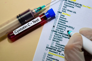 Cystatin C - Test with blood sample. Top view isolated on office desk. Healthcare/Medical concept