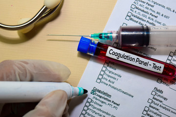 Coagulation Panel - Test with blood sample. Top view isolated on office desk. Healthcare/Medical...