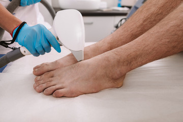 Beautician removing hair on the feet of a man, using laser hair removal machine