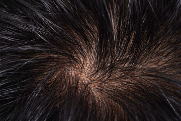 Close-up on Asian Woman Black Hair and Scalp