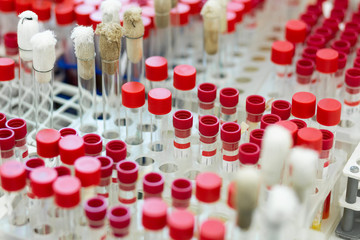 Close up of test tubes that being on support