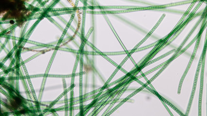 Study of Oscillatoria is a genus of filamentous cyanobacterium, oscillation in its movement under...