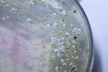 Backgrounds of Characteristics and Different shaped Colony of Bacteria and Mold growing on agar plates from Soil samples for education in Microbiology laboratory.