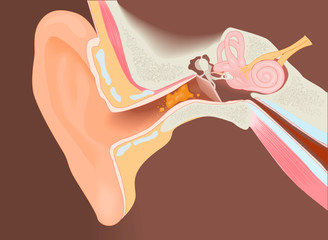 Section of the ear with the wax - obrazy, fototapety, plakaty