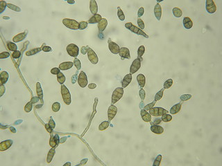 Alternaria sp.