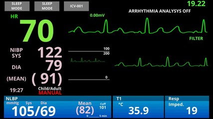 Medical vital signs monitor, cardio sensor patient health condition diagnostic
