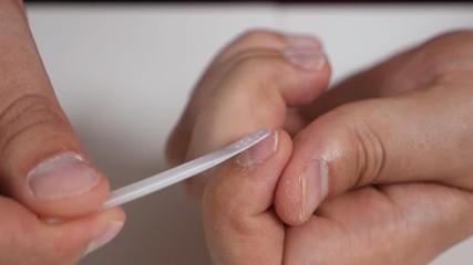 Toenail fungus. Man at home treat nail fungus, special medicine, medicines