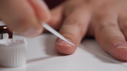 Toenail fungus. Man at home treat nail fungus, special medicine, medicines