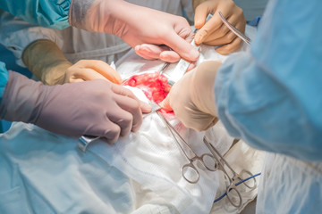 a team of surgeons performing a kidney operation in a sterile operating room
