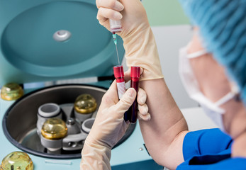 Platelet-Rich plasma preparation. Plasma in syringe. Centrifuge.