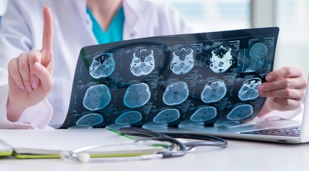 Doctor examining MRI image in hospital