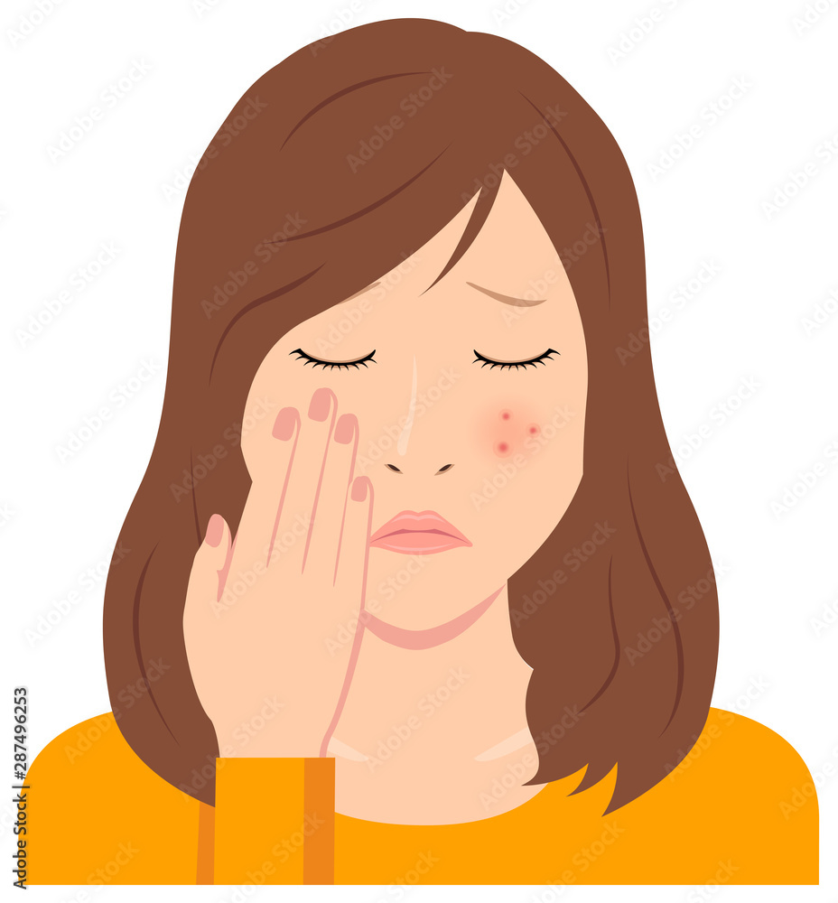 Wall mural Young woman vector illustration (upper body) / acne, pimple, treckles, rash 