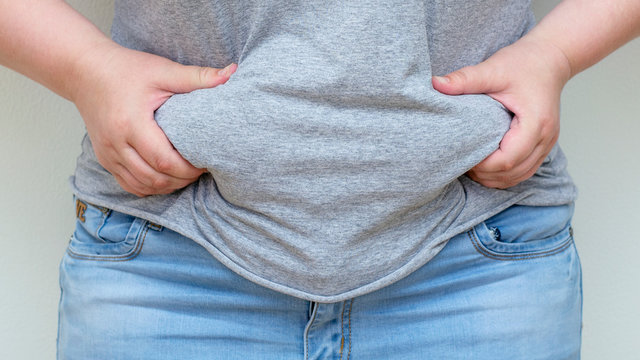 Obesity. Obese Woman Holding His Belly Fat With Both Hands Giving An Expression Of Shock.