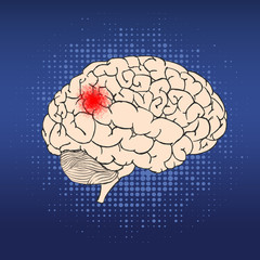 human brain with red point