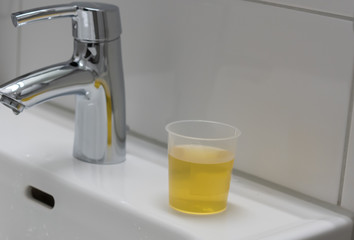 annual inspection of woman health at the gynecologist in the toilet, pee in a plastic cup for analysis.