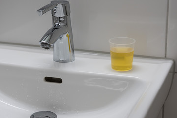 Urine in a plastic cup for analysis near faucet of white sink. Annual inspection of woman health at the gynecologist in the toilet.