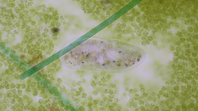 Frontonia sp. is a genus of free-living unicellular ciliate protists under the microscope.
