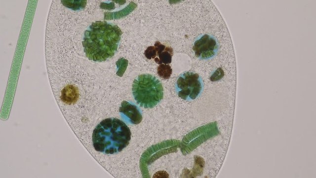 Frontonia sp. is a genus of free-living unicellular ciliate protists under the microscope.