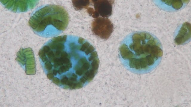 Frontonia sp. is a genus of free-living unicellular ciliate protists under the microscope.