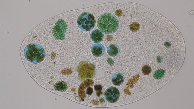 Frontonia sp. is a genus of free-living unicellular ciliate protists under the microscope.