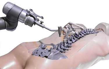 Surgical robot for spinal surgery