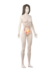3d rendered medically accurate illustration of a womans large intestine cancer