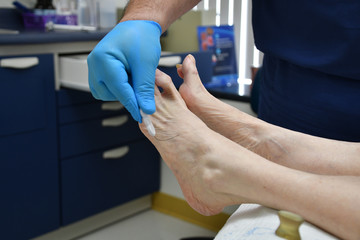 Obraz premium Podiatrist Foot Fungus Bunion