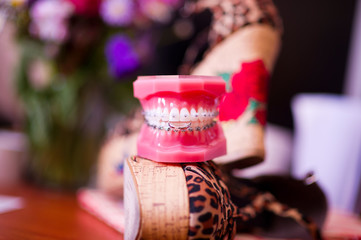 training jaw clamps the engagement ring. Hooligan wedding. Wedding jokes