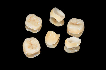 ceramic crowns of human teeth closeup macro isolate on a black background. The concept of aesthetic...