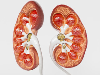 Kidney stones in the cross section of a kidney - 3D Rendering