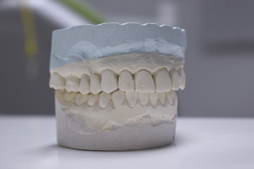 prosthesis model in dental office