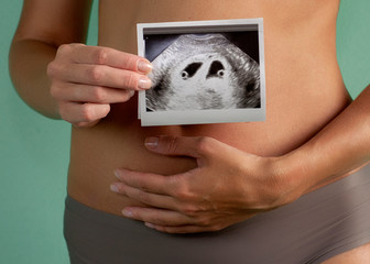 The girl is holding a snapshot of an ultrasound twin in the fourth week of pregnancy. First trimester. Confirmation of pregnancy.