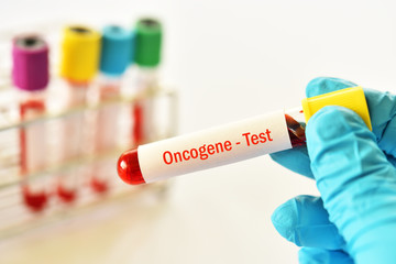 Blood sample tube for oncogene test, cancer gene detection