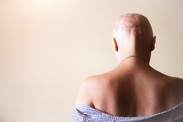 Henna mehndi tattoo on womans bald head